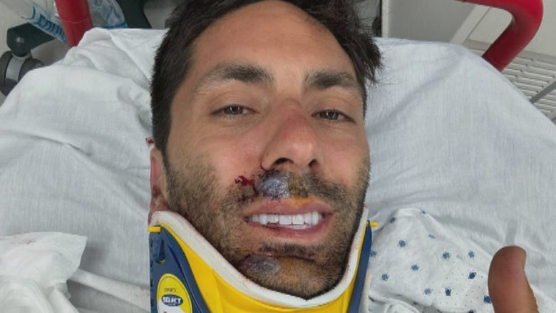 'Catfish' Star Nev Schulman Breaks Neck in Bike Accident