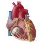 Right atrium and ventricle