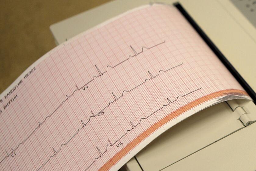 FILE - This May 26, 2009 file photo shows a printout from an electrocardiogram machine in Missouri. Doctors are reporting that novel drugs may offer fresh ways to reduce heart risks beyond the usual medicines to lower cholesterol and blood pressure. One new study found that heart attack survivors benefited from a medicine long used to treat gout. Gene-targeting medicines also showed promise in studies discussed Monday, Nov. 18, 2019, at an American Heart Association conference in Philadelphia. (AP Photo/Jeff Roberson)