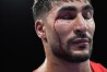 Blood drips down the face of Italy's Aziz Mouhiidine after his loss to Uzbekistan's Lazizbek Mullojonov in their men's 92 kg preliminary boxing match at the 2024 Summer Olympics, Sunday, July 28, 2024, in Paris, France. (AP Photo/John Locher)