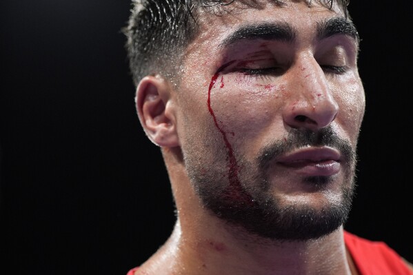 Blood drips down the face of Italy's Aziz Mouhiidine after his loss to Uzbekistan's Lazizbek Mullojonov in their men's 92 kg preliminary boxing match at the 2024 Summer Olympics, Sunday, July 28, 2024, in Paris, France. (AP Photo/John Locher)