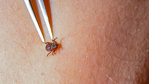 Tick being removed with tweezers (Credit: Alamy)