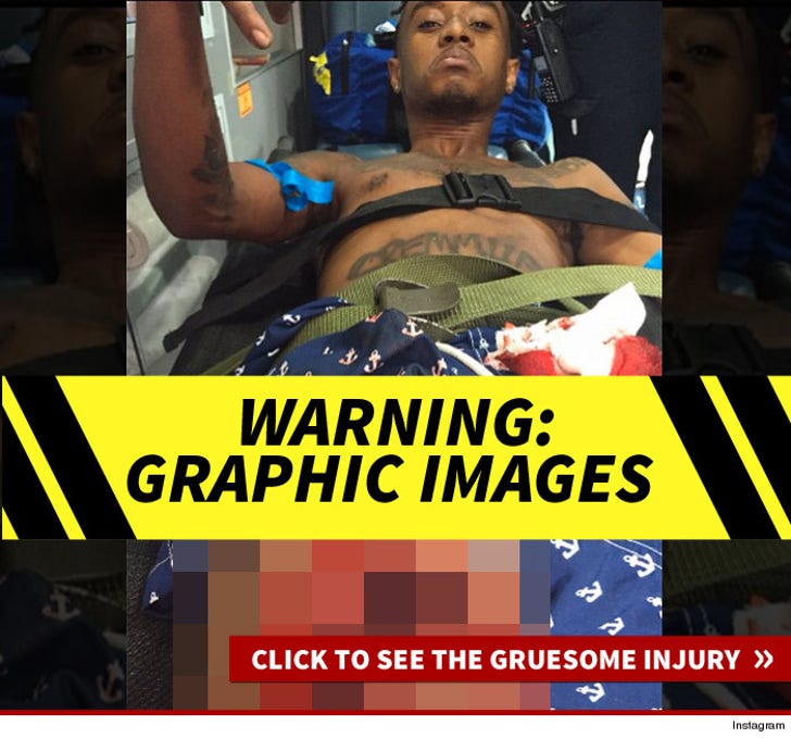 Rae Sremmurd's Gruesome Injury Photos