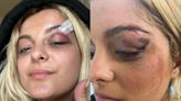 Bebe Rexha ‘fan’ charged with assault after singer hit with phone during concert